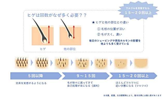 ヒゲ